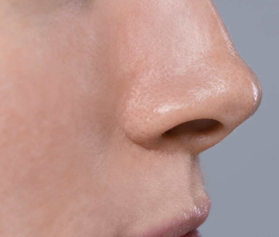 skinporter after